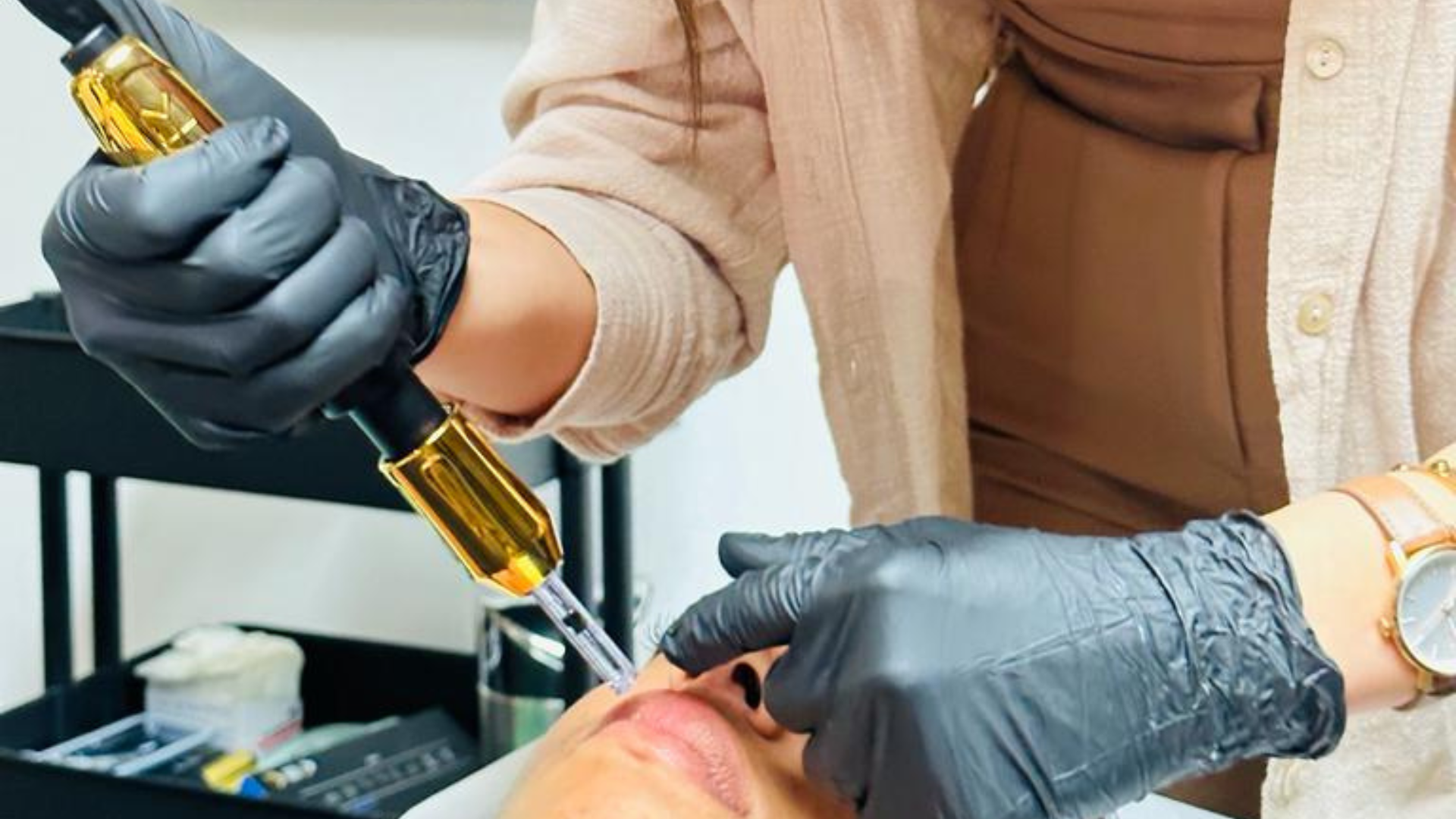 IRI Filler Behandlung